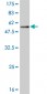 TREM1 Antibody (monoclonal) (M01)
